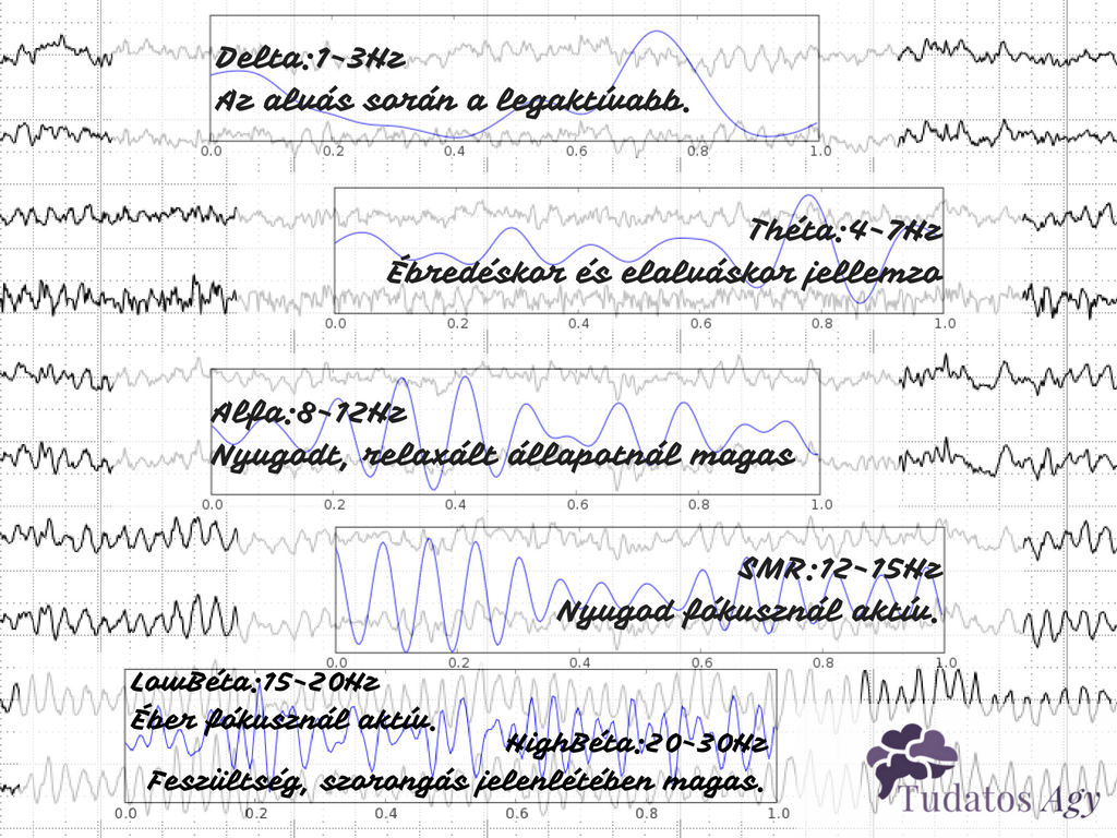 Neurofeedback agyhullámok